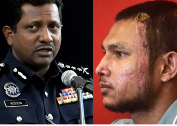 USJT Bukit Aman kendali kes simbah asid Faisal Halim